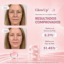 GlowUp™ | Máscara de Colágeno PDRN de Salmão